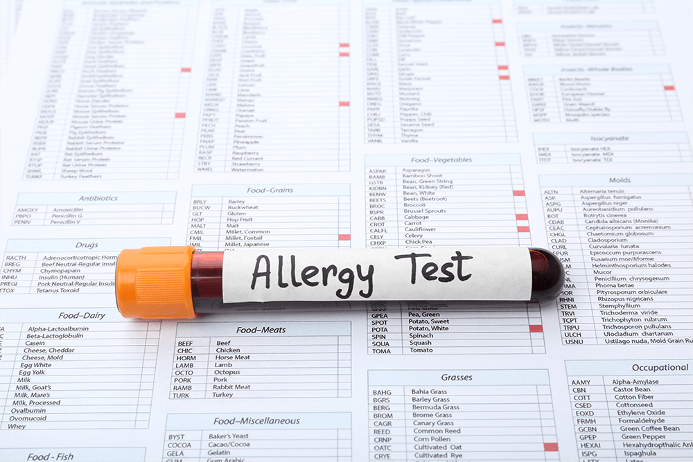 アレルギーの血液検査